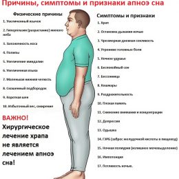 Что такое апноэ сна?