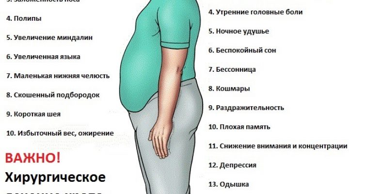 Что такое апноэ сна?